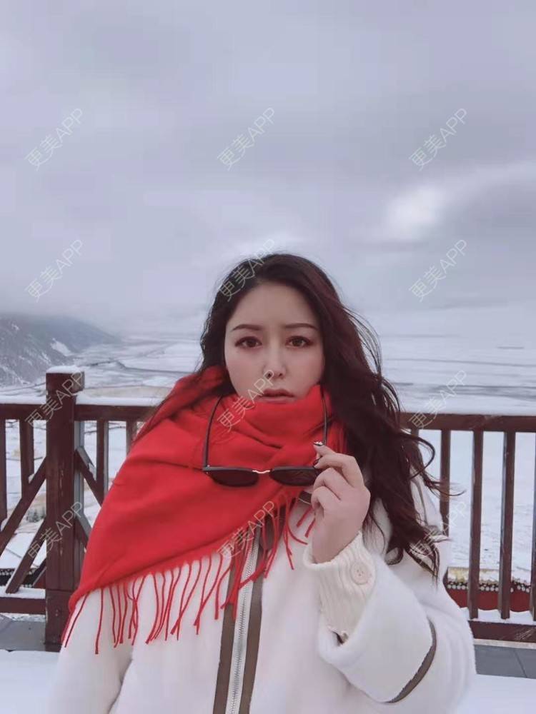 更美 - 更美用户dapPewZ45A的自体脂肪丰额头经验 | 自体脂肪丰额头 | 重庆