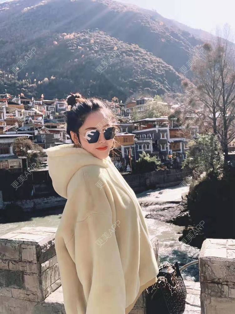 更美 - 更美用户dapPewZ45A的自体脂肪丰额头经验 | 自体脂肪丰额头 | 重庆