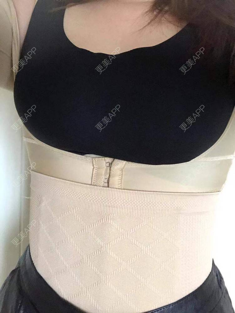 腰腹吸脂 | 吸脂瘦大腿 | 手臂吸脂 | 背部吸脂 | 吸脂 | 假体隆胸