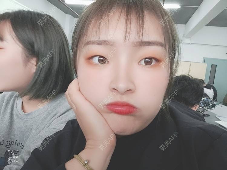 更美 - 更美用户nNWsnihnef的彩光嫩肤经验 | 彩光嫩肤