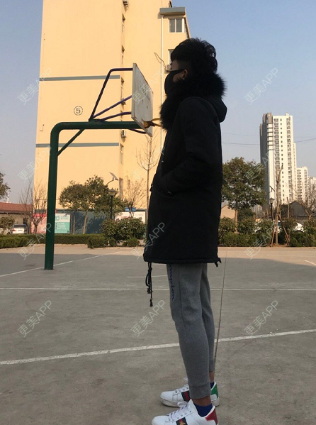 更美 - 更美用户cN38w33s2O的手术除腋臭经验 | 手术除腋臭 | 重庆