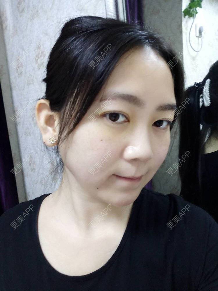 更美 - 更美用户HOXcRi8TmU的膨体垫眉弓经验 | 膨体垫眉弓