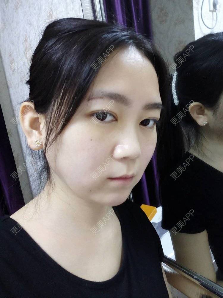 更美 - 更美用户HOXcRi8TmU的膨体垫眉弓经验 | 膨体垫眉弓