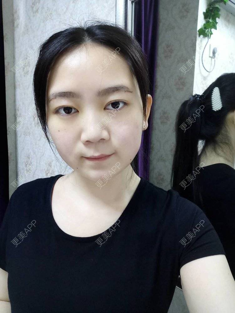 更美 - 更美用户HOXcRi8TmU的膨体垫眉弓经验 | 膨体垫眉弓