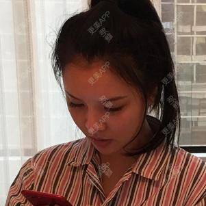 更美 - 更美用户kvJsJX5BDg的拉皮经验 | 深圳 | 拉皮