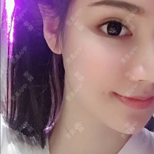 更美 - 更美用户kvJsJX5BDg的拉皮经验 | 深圳 | 拉皮