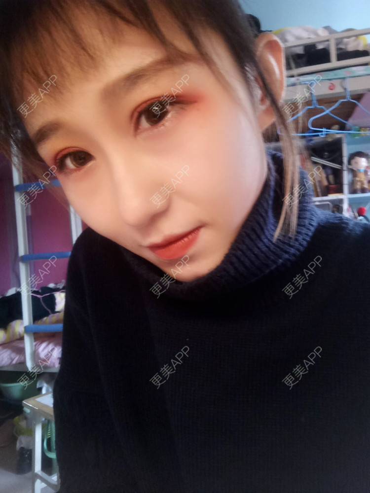 更美 - 周其光 医生的全切双眼皮经验 | 全切双眼皮 | 无锡