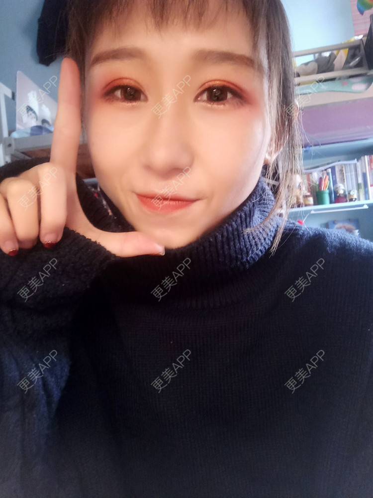 更美 - 周其光 医生的全切双眼皮经验 | 全切双眼皮 | 无锡