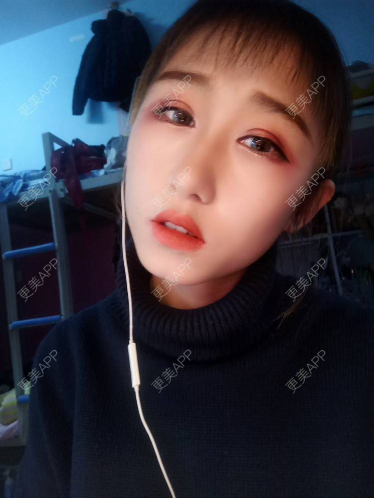 更美 - 周其光 医生的全切双眼皮经验 | 全切双眼皮 | 无锡