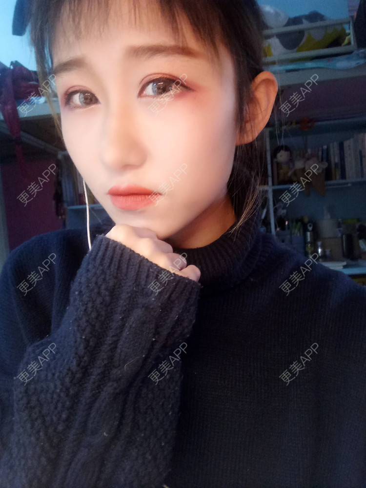 更美 - 周其光 医生的全切双眼皮经验 | 全切双眼皮 | 无锡