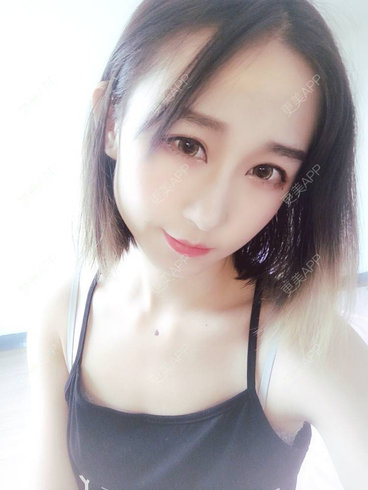 更美 - 周其光 医生的全切双眼皮经验 | 全切双眼皮 | 无锡