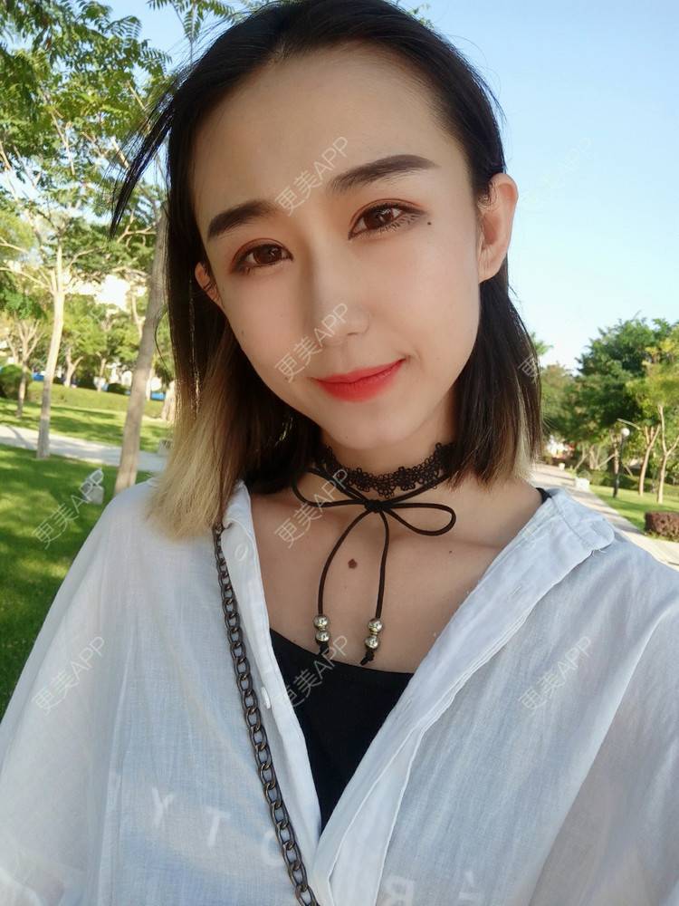 更美 - 周其光 医生的全切双眼皮经验 | 全切双眼皮 | 无锡