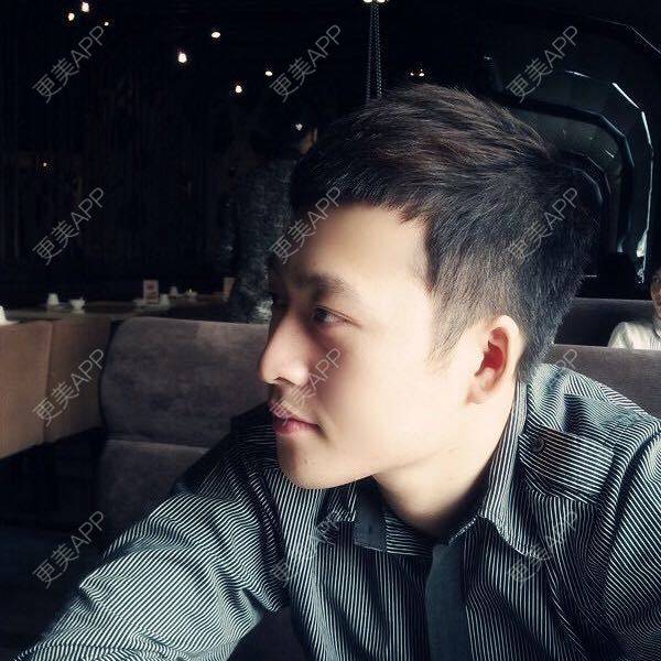 更美 - 巴黎左岸_的植发际线经验 | 上海 | 植发际线