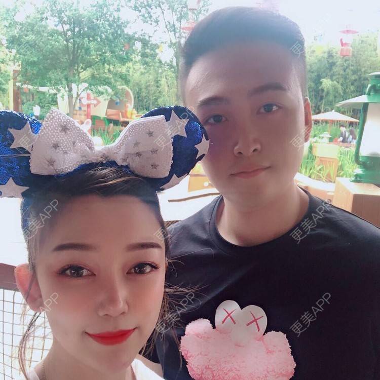 更美 - 巴黎左岸_的植发际线经验 | 上海 | 植发际线