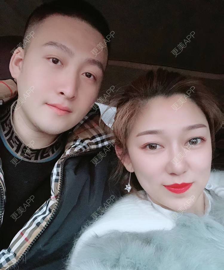 更美 - 巴黎左岸_的植发际线经验 | 上海 | 植发际线