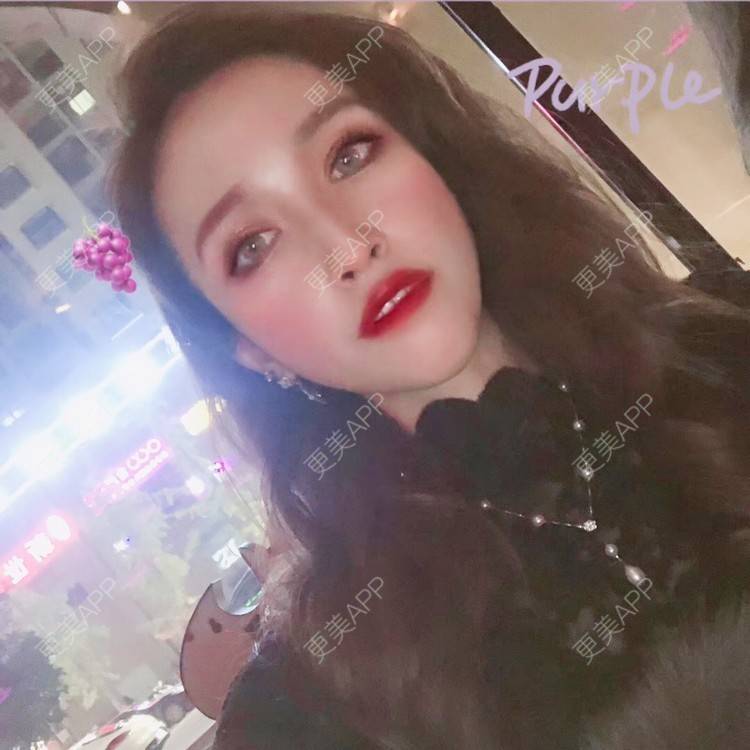 更美 - 丢了灵魂的孩纸的唇腭裂修复经验 | 厚唇改薄 | 唇腭裂修复 | 玻尿酸唇部 | 自体脂肪丰唇 | 胶原蛋白丰唇