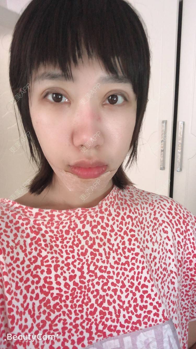 更美 - 🍬肉肉肉肉丝的下巴经验 | 下巴 | 哈尔滨