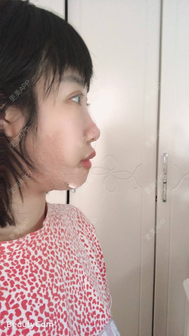 更美 - 🍬肉肉肉肉丝的下巴经验 | 下巴 | 哈尔滨