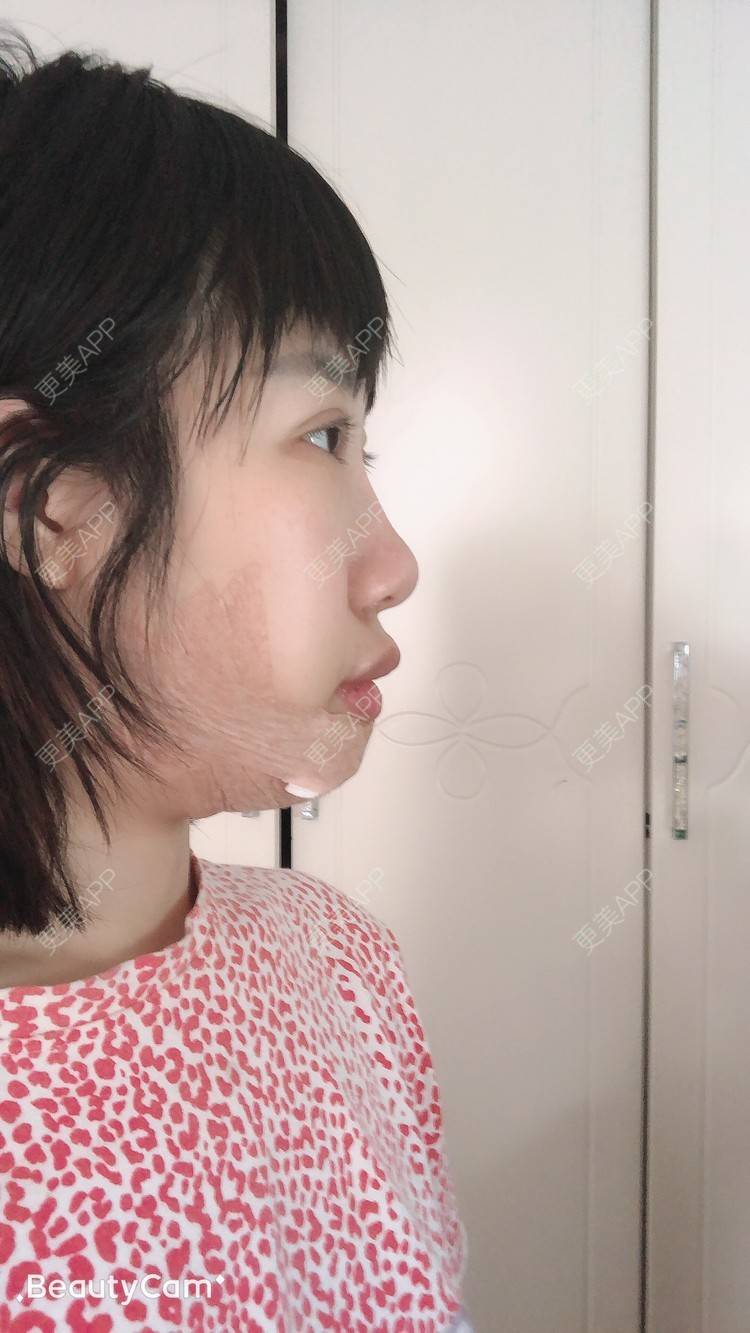 更美 - 🍬肉肉肉肉丝的下巴经验 | 下巴 | 哈尔滨