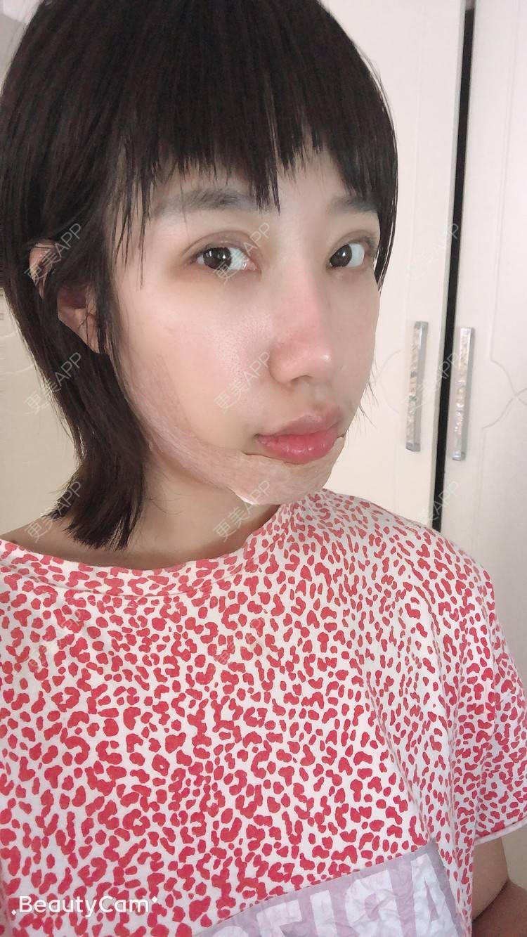 更美 - 🍬肉肉肉肉丝的下巴经验 | 下巴 | 哈尔滨