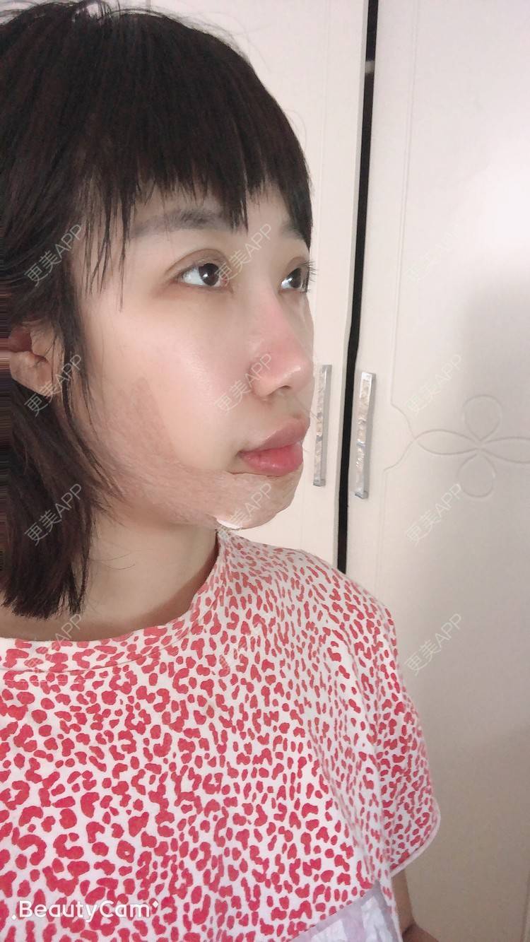 更美 - 🍬肉肉肉肉丝的下巴经验 | 下巴 | 哈尔滨