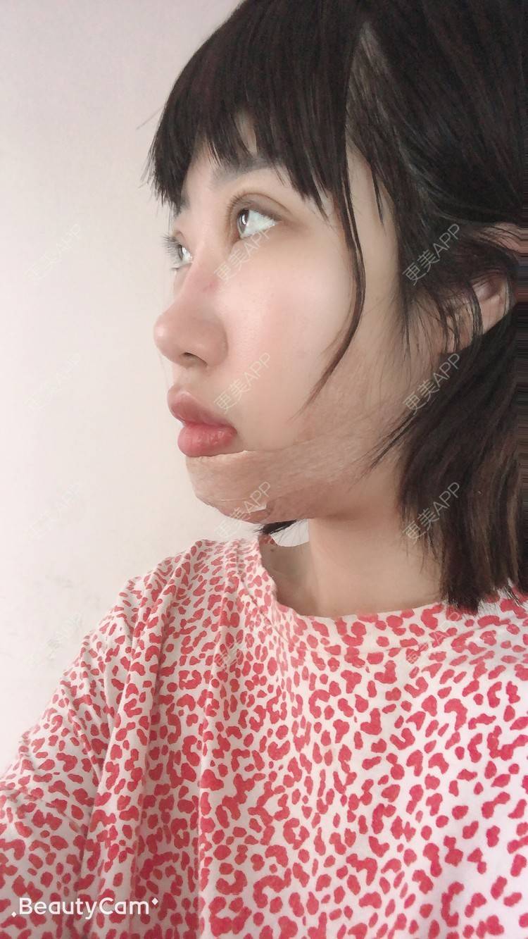 更美 - 🍬肉肉肉肉丝的下巴经验 | 下巴 | 哈尔滨