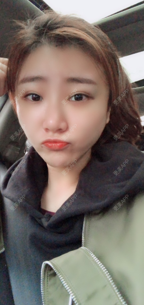 更美 - 更美用户IghjRWworf的自体脂肪填充颈纹经验 | 自体脂肪填充颈纹 | 重庆