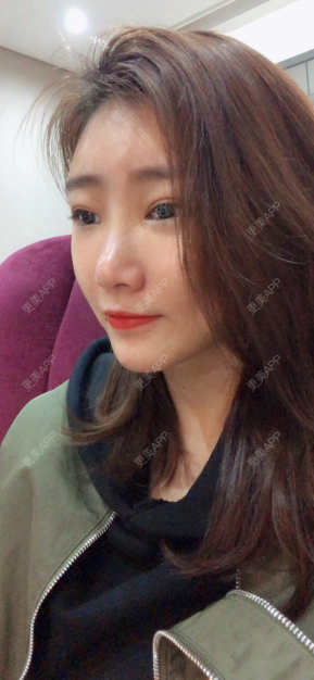 更美 - 更美用户IghjRWworf的自体脂肪填充颈纹经验 | 自体脂肪填充颈纹 | 重庆