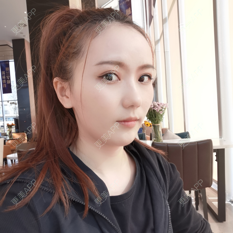 痞人来回薇的额头日记