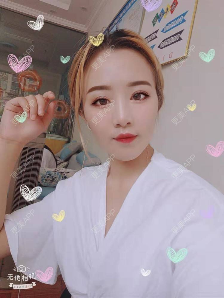 更美 - 更美用户cZDofR1cWa的双眼皮修复经验 | 成都 | 双眼皮修复