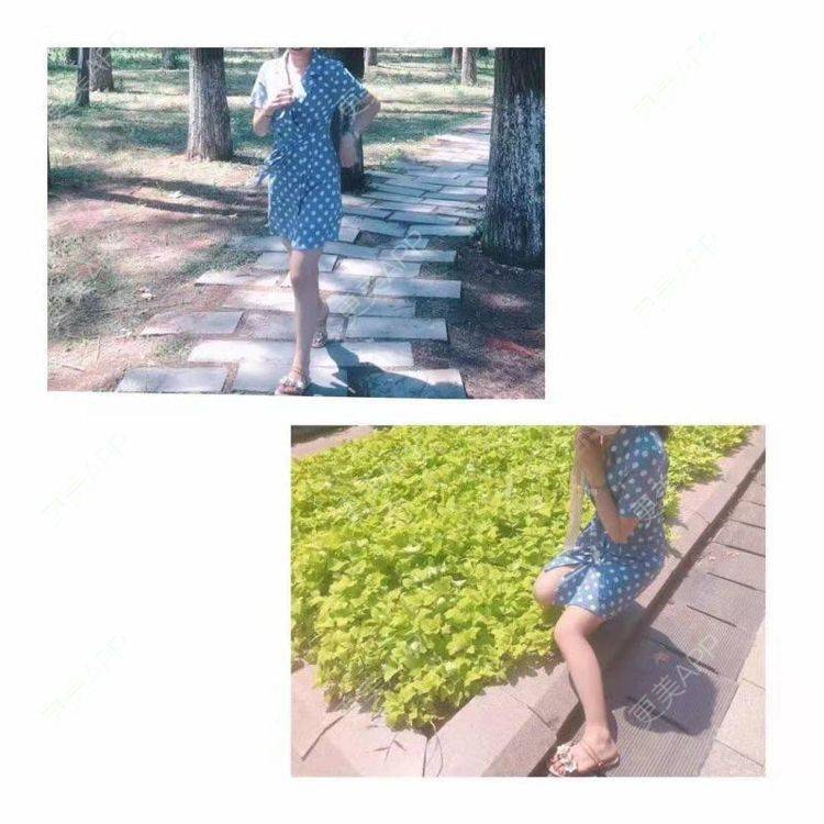 更美 - 更美用户eSTpqoXPDp的阴蒂整形经验 | 上海 | 阴蒂整形