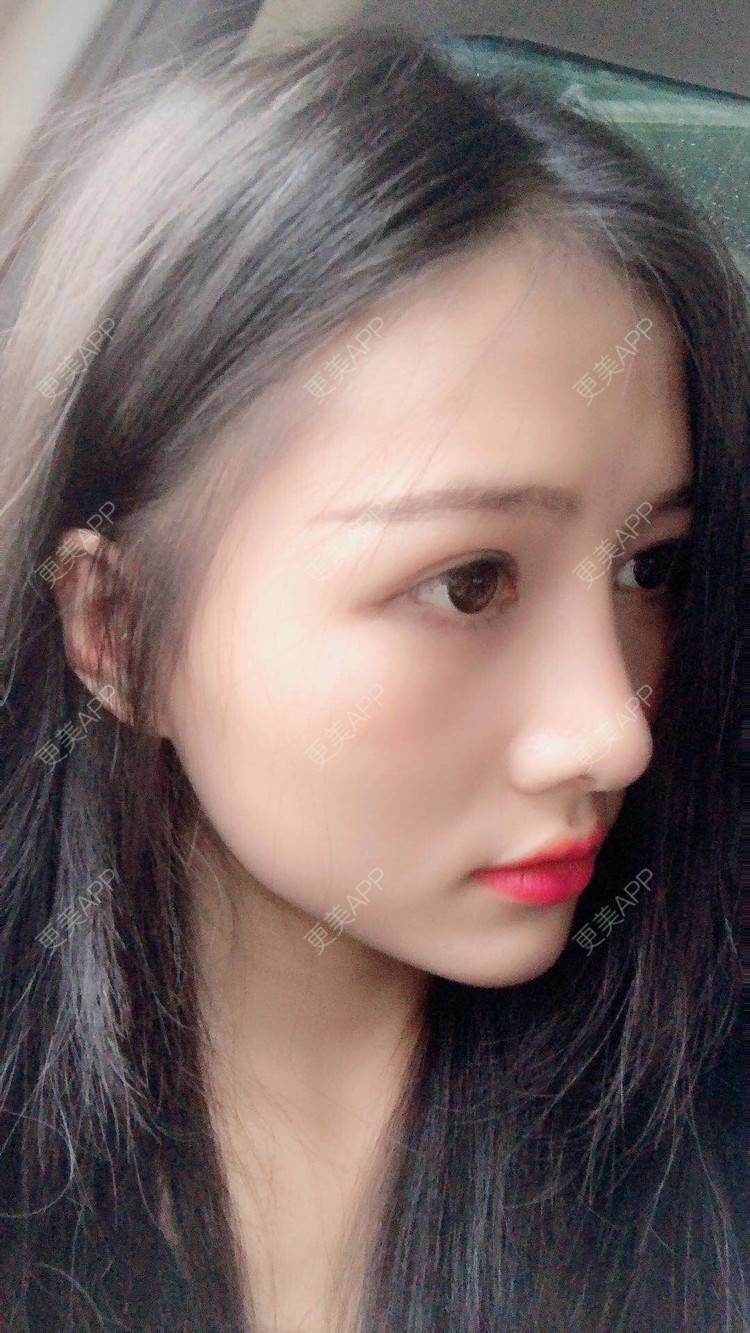更美用户ymwbwaadj7的鼻综合日记