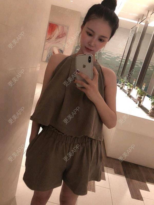 更美 - 更美用户ig5gOaR2Fp的双下巴溶脂经验 | 双下巴溶脂 | 深圳