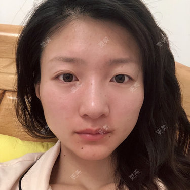 惜你若命_x