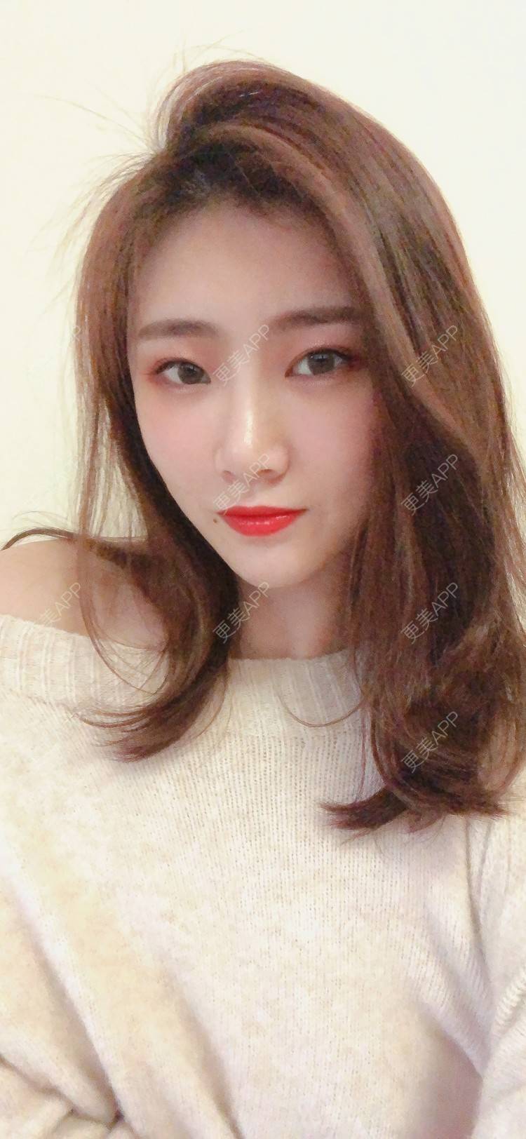 更美 - 更美用户IghjRWworf的自体脂肪填充颈纹经验 | 自体脂肪填充颈纹 | 重庆