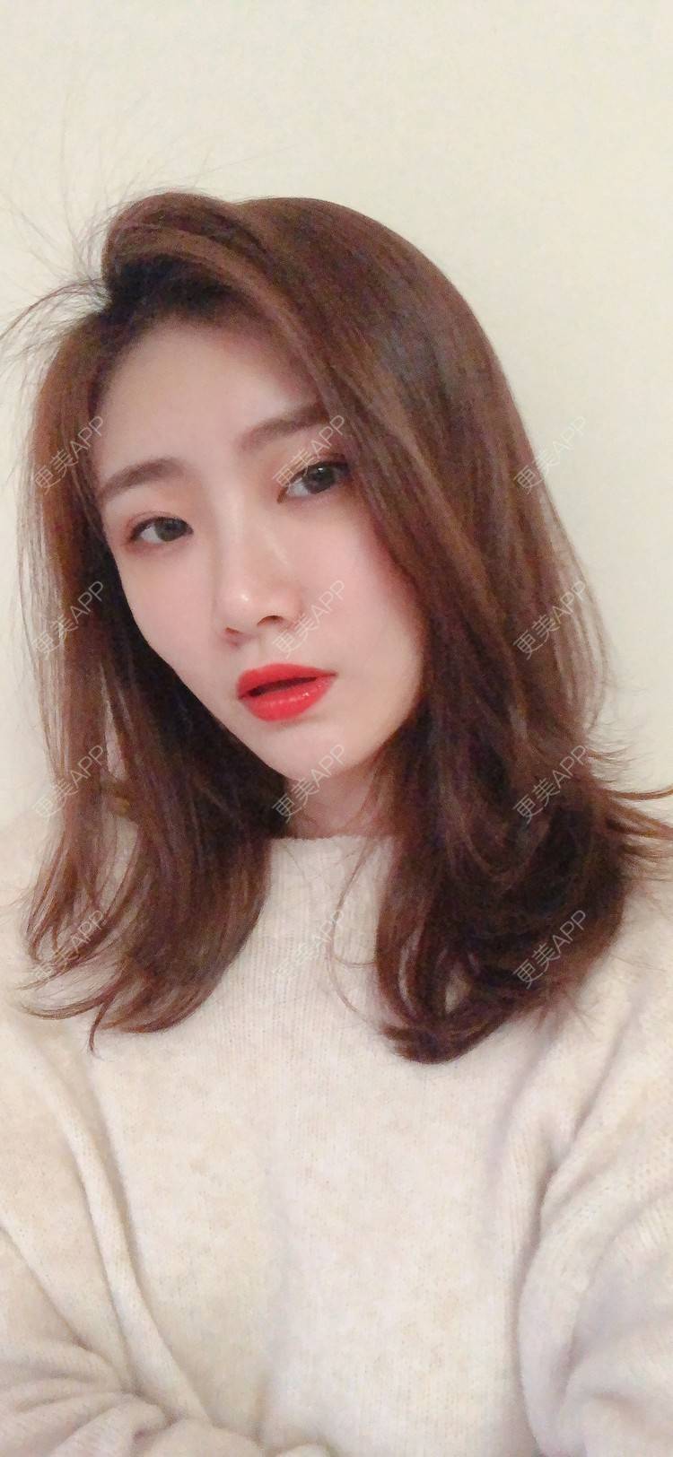 更美 - 更美用户IghjRWworf的自体脂肪填充颈纹经验 | 自体脂肪填充颈纹 | 重庆