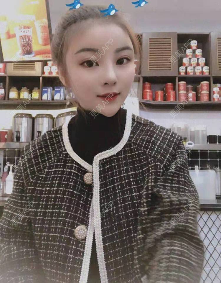 更美 - 静静j的自体脂肪丰额头经验 | 上海 | 自体脂肪丰额头