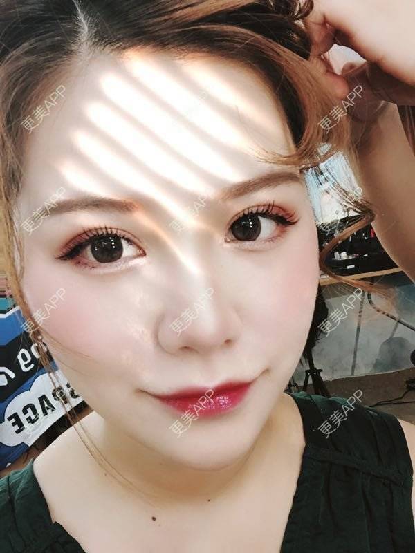 更美 - 不是不喜欢肖战的眼部多项经验 | 眼部多项 | 武汉
