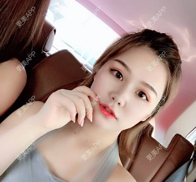 更美 - 不是不喜欢肖战的眼部多项经验 | 眼部多项 | 武汉