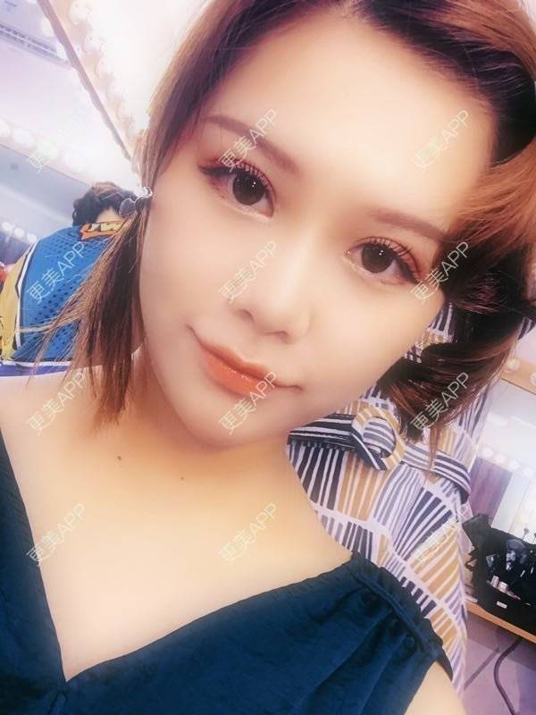 更美 - 不是不喜欢肖战的眼部多项经验 | 眼部多项 | 武汉