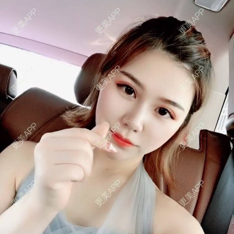 更美 - 不是不喜欢肖战的眼部多项经验 | 眼部多项 | 武汉