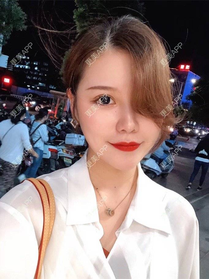 更美 - 不是不喜欢肖战的眼部多项经验 | 眼部多项 | 武汉