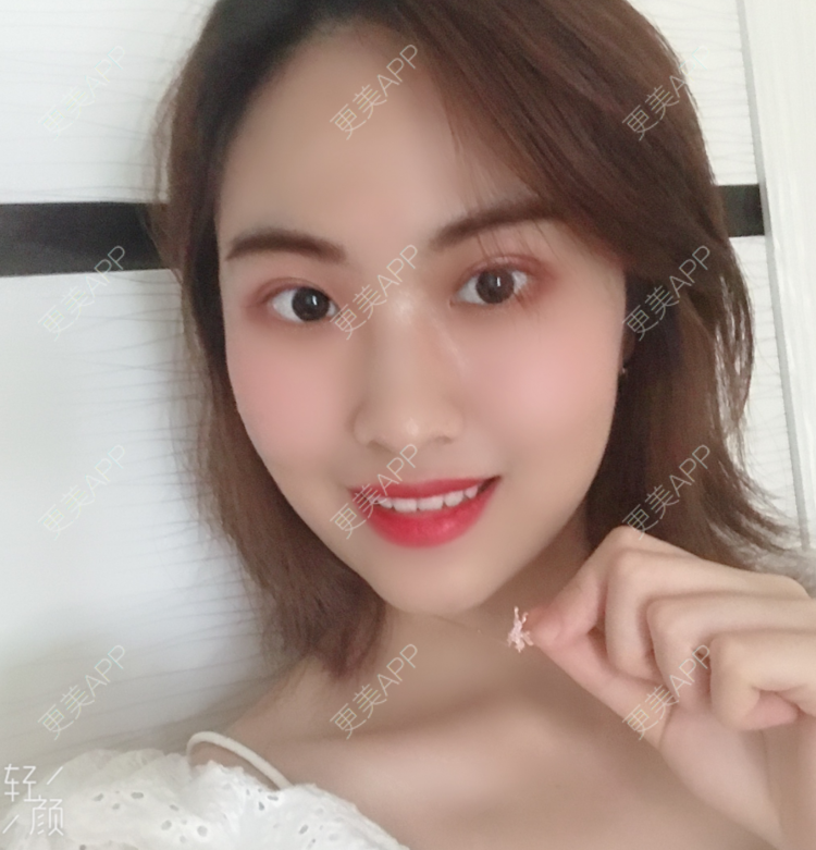 更美用户aNhLk6wUcM的双眼皮日记