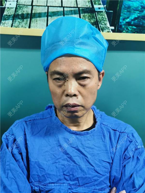 更美 - 更美用户IG0lQLfUjW的外切去眼袋经验 | 杭州 | 外切去眼袋