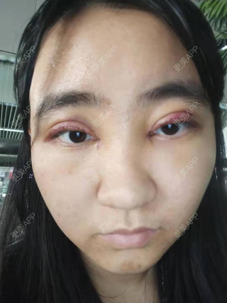 更美 - 你的女朋友的眼部多项经验 | 眼部多项 | 铜川