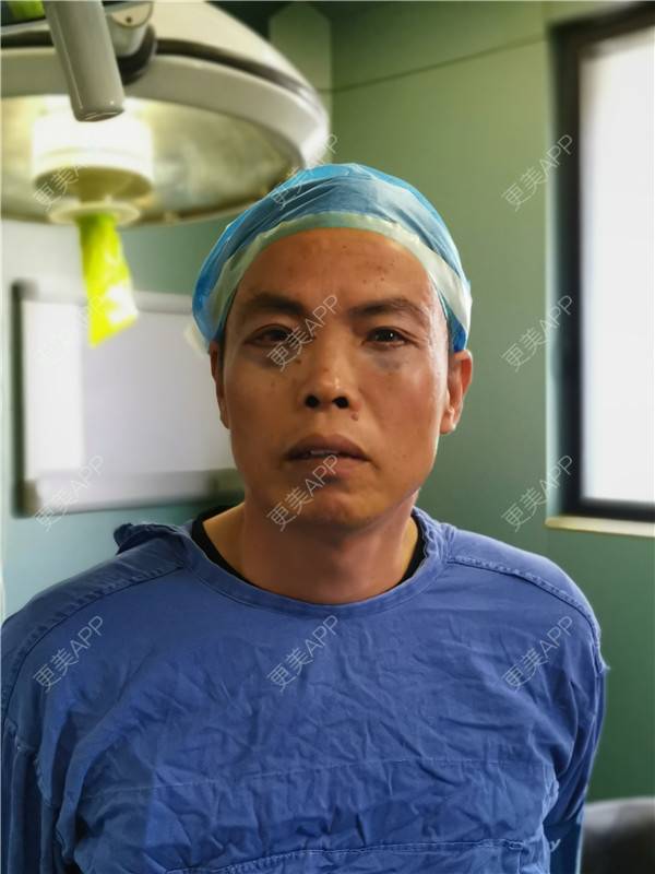 更美 - 更美用户IG0lQLfUjW的外切去眼袋经验 | 杭州 | 外切去眼袋