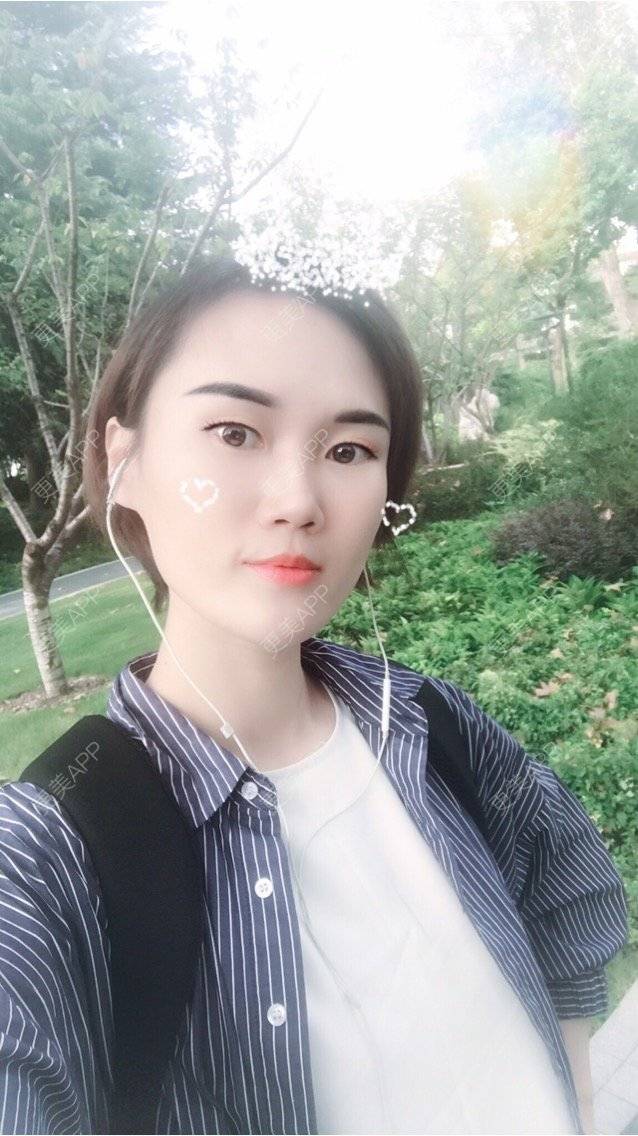 更美 - 安迪🌷的玻尿酸面颊经验 | 上海 | 玻尿酸面颊