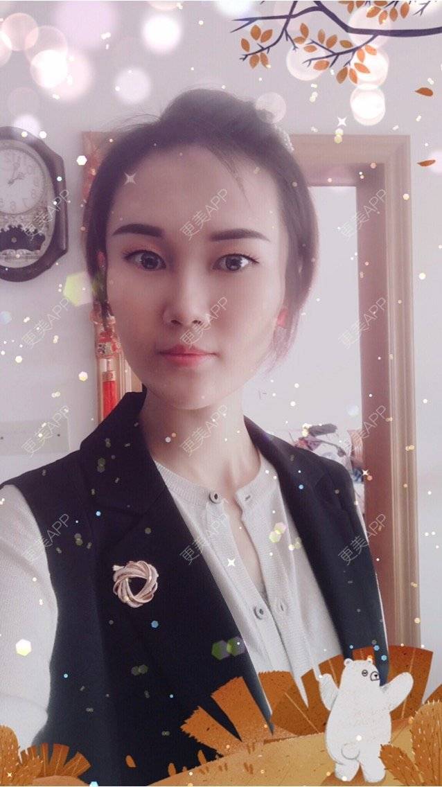更美 - 安迪🌷的玻尿酸面颊经验 | 上海 | 玻尿酸面颊