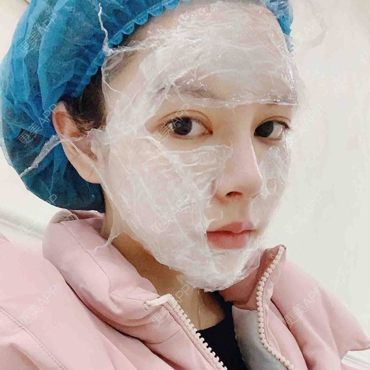 更美 - 更美用户uiIaqtaVR1的隆鼻经验 | 杭州 | 肋软骨隆鼻 | 隆鼻 | 微针水光