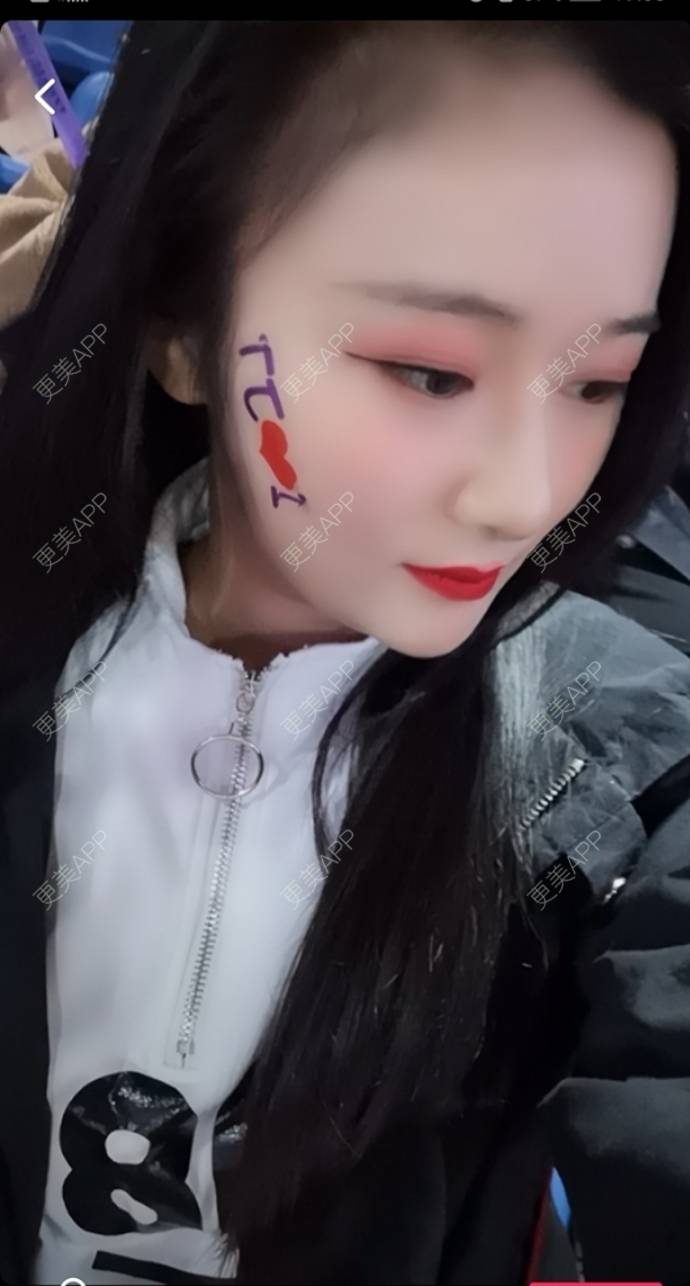 更美 - 更美用户J1mgNZN5cT的鼻部多项经验 | 视频日记 | 鼻部多项 | 成都